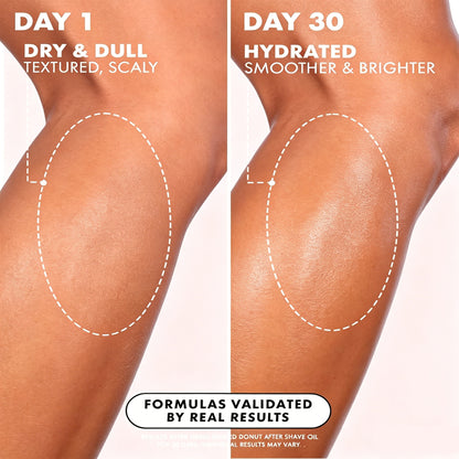 Glazed Donut After Shave Oil – Ingrown Hair & Discoloration Treatment