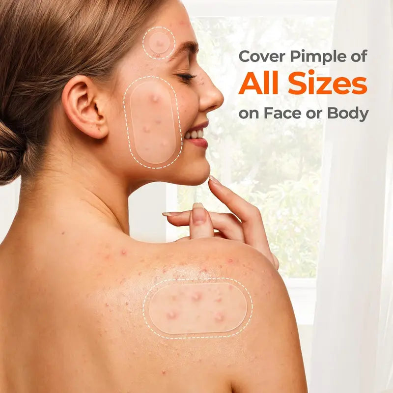 Hydrocolloid Pimple Patches Bulk (609 Count) - Anti-Acne Treatment