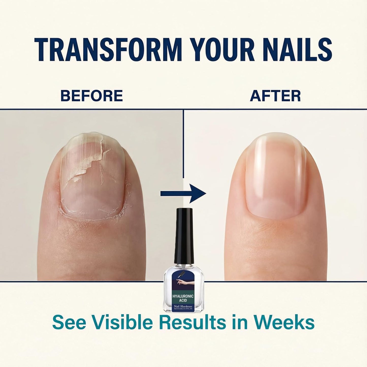 2Pcs Nail Strengthener & Repair Serum, Hydrating Nail Care for Weak, Dry & Peeling Nails