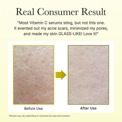 Vitamin C Booster Shot Serum for Glass Skin, Korean Skincare 30ml/1.01 fl.oz