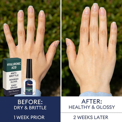 2Pcs Nail Strengthener & Repair Serum, Hydrating Nail Care for Weak, Dry & Peeling Nails