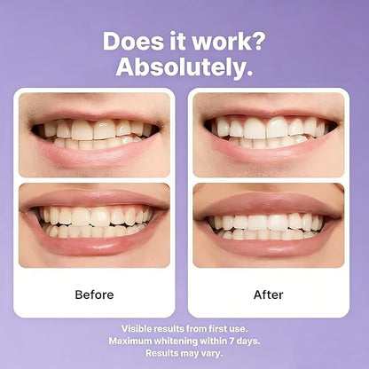 42 Strips Purple Teeth Whitening Strips - Fast Dissolving Teeth Whitening Strips, Tooth Stain Treatment, Portable