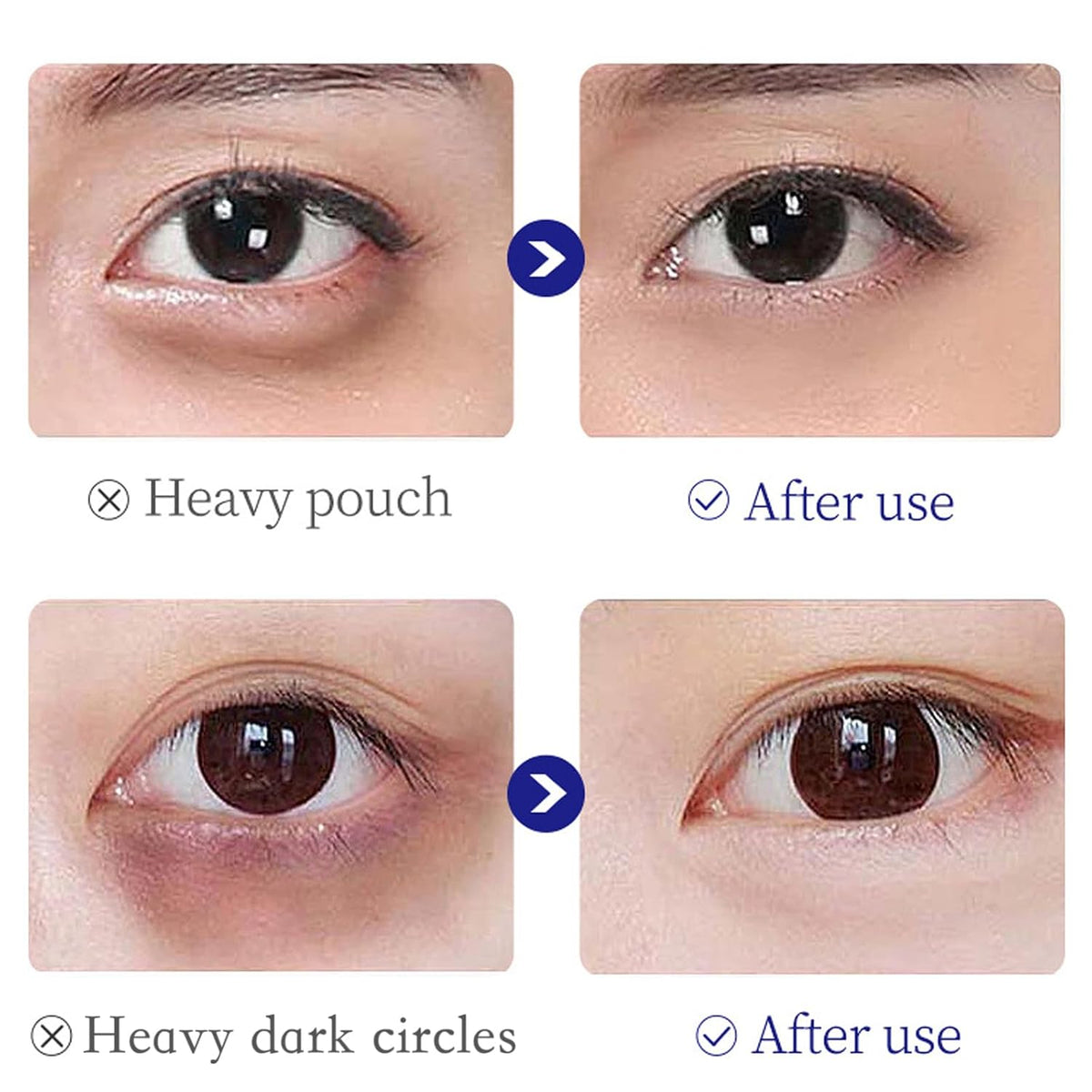 Collagen-Infused Under Eye Cream Puffiness Relief, Brightening, Firming