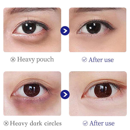 Collagen-Infused Under Eye Cream Puffiness Relief, Brightening, Firming
