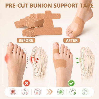 20Pcs Pre-Cut Bunion Support Tape, Elastic Breathable Latex-Free Kinesiology Tape