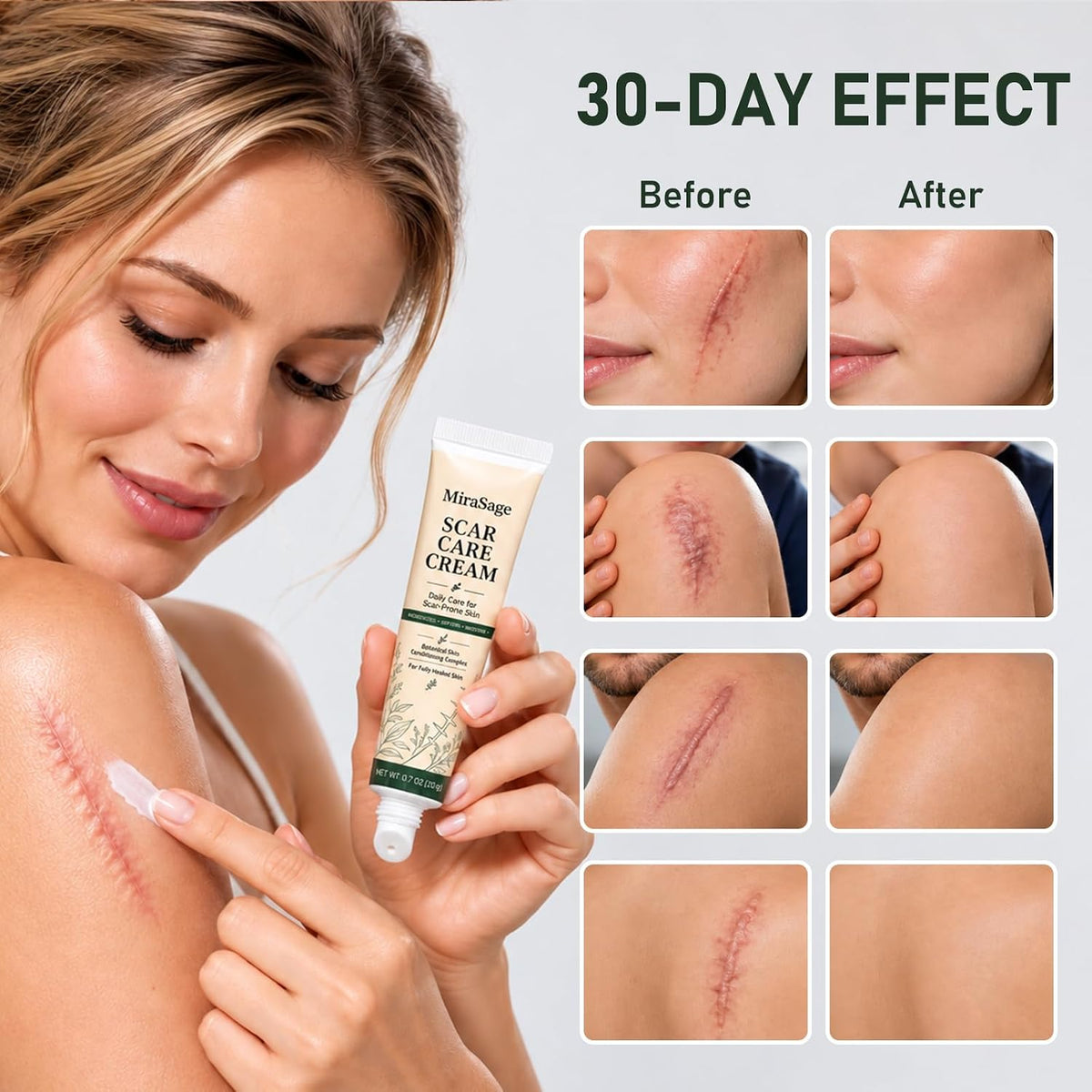 Botanical Scar Care Cream, Daily Care for Scar-Prone Skin