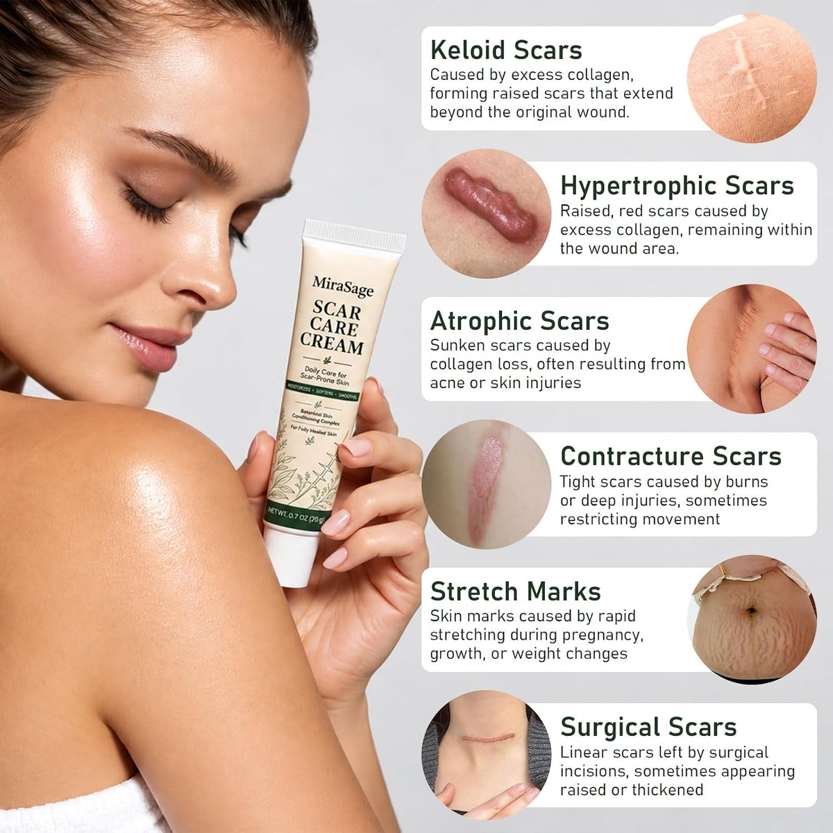 Botanical Scar Care Cream, Daily Care for Scar-Prone Skin