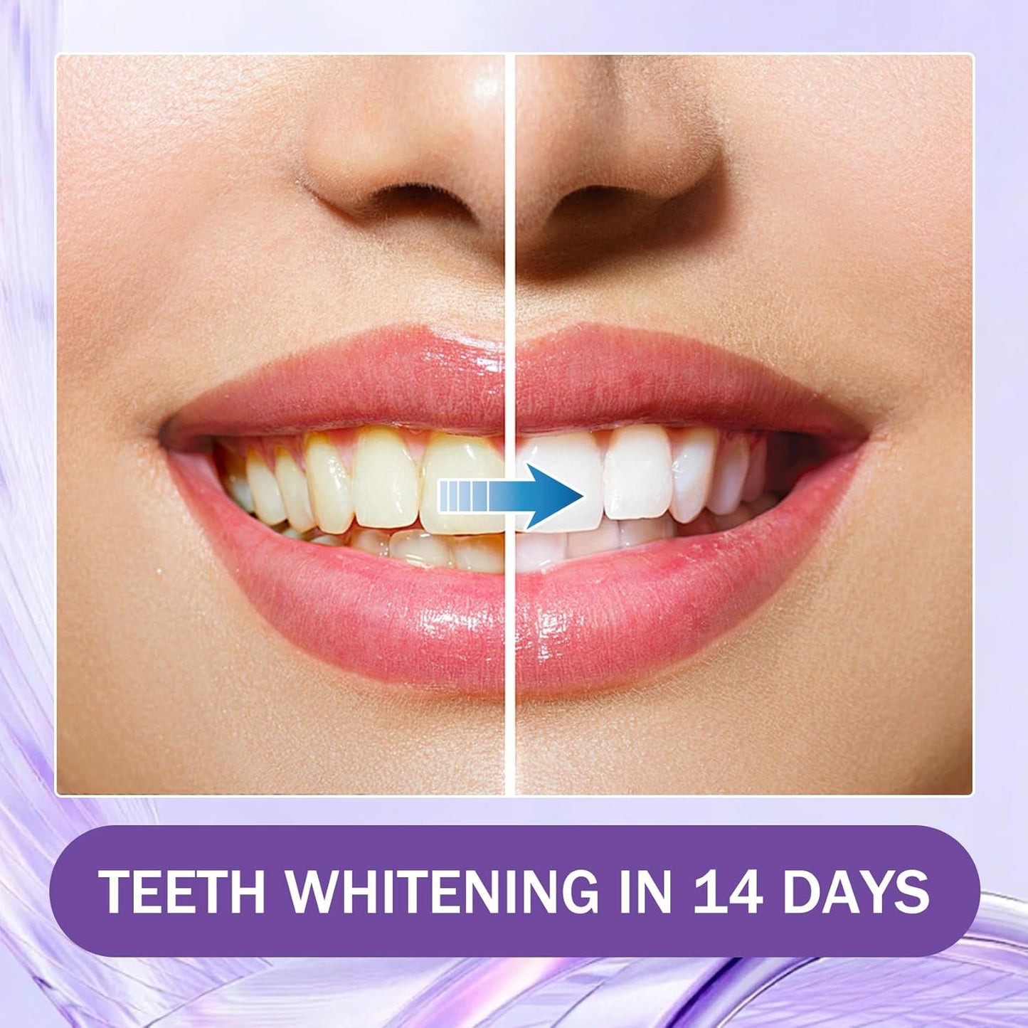 14 Pack Gentle Daily Purple Teeth Whitening Strips – Enamel-Friendly
