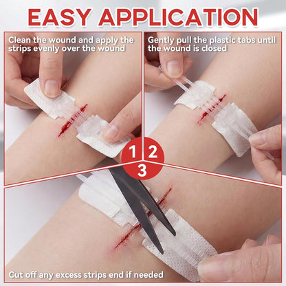 3 PCS Wound Closure Strips Without Stitches