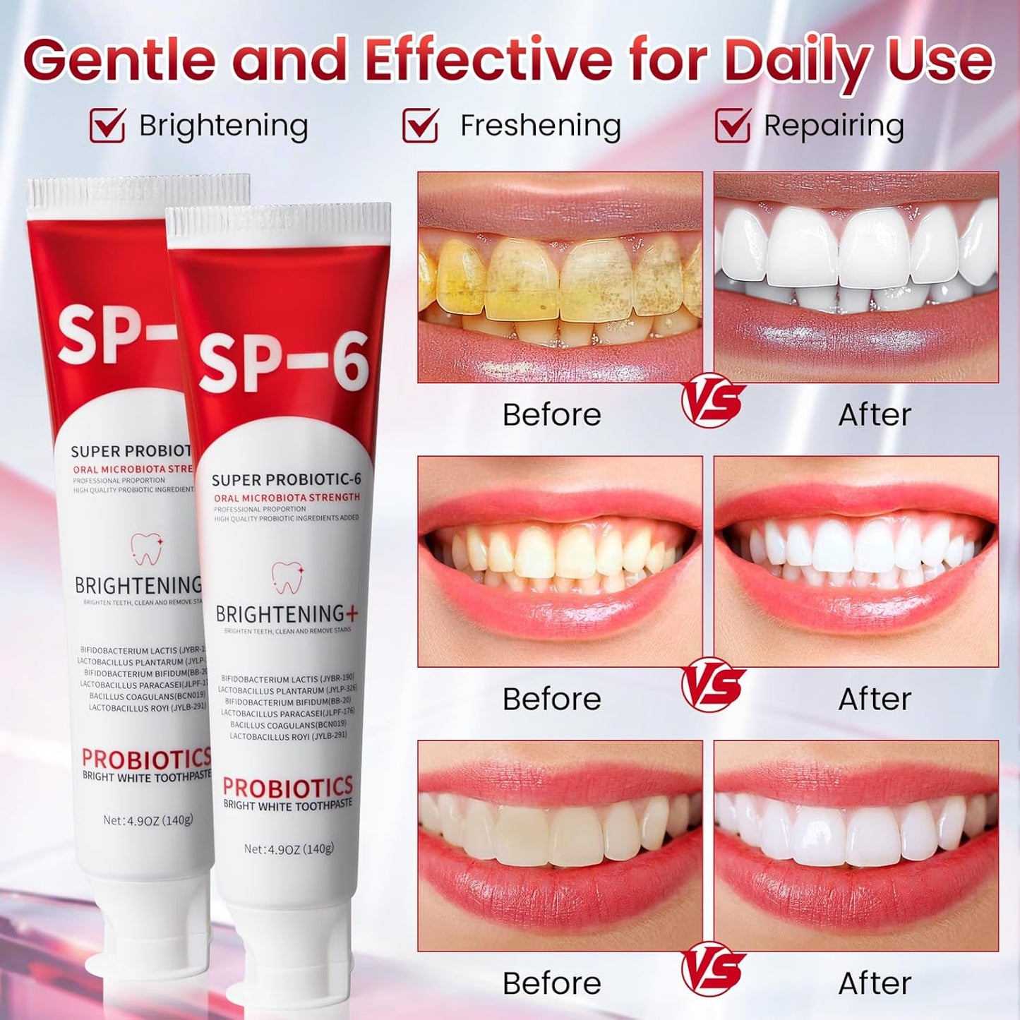 2Pcs SP-6 Probiotic Whitening Toothpaste with 6 Probiotics for Teeth Whitening/Brightening, Enamel-Safe