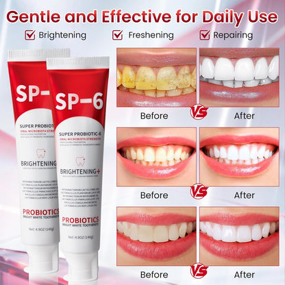 2Pcs SP-6 Probiotic Whitening Toothpaste with 6 Probiotics for Teeth Whitening/Brightening, Enamel-Safe