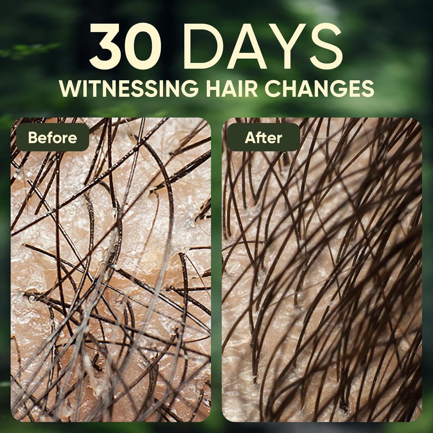 Batana Oil Shampoo, Rosemary Oil Shampoo with Rosemary Extract, Suitable for Men & Women