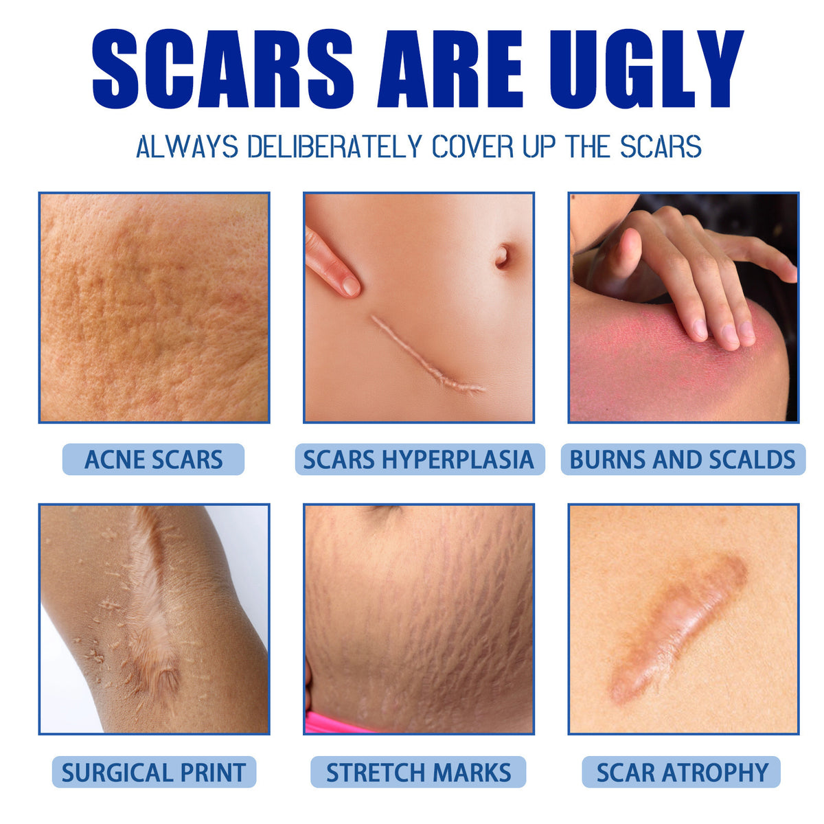 Scar Removal Cream,Scar Soothing Cream