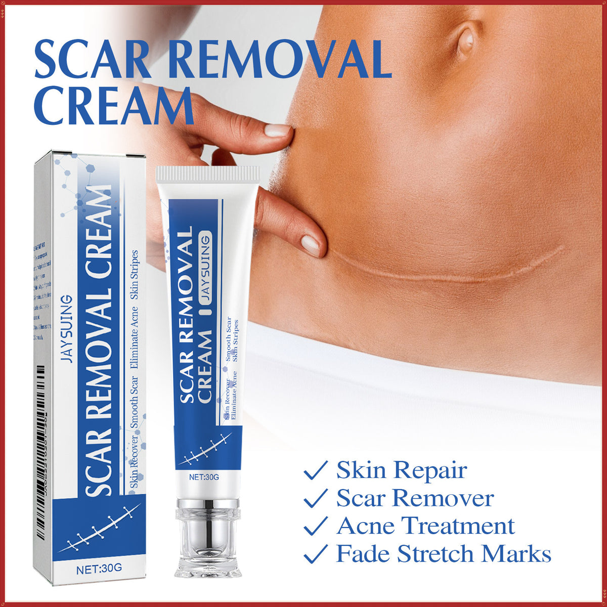 Scar Removal Cream,Scar Soothing Cream