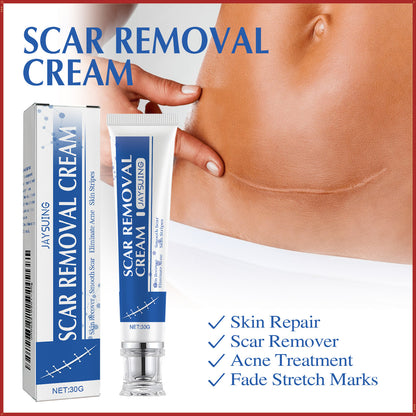 Scar Removal Cream,Scar Soothing Cream