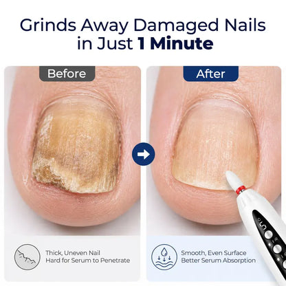 Electric Nail Drill for Thick Nails, Cordless Efiles for fungal Nails Lightweight