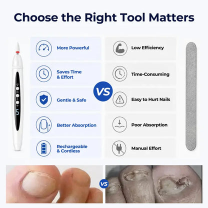 Electric Nail Drill for Thick Nails, Cordless Efiles for fungal Nails Lightweight